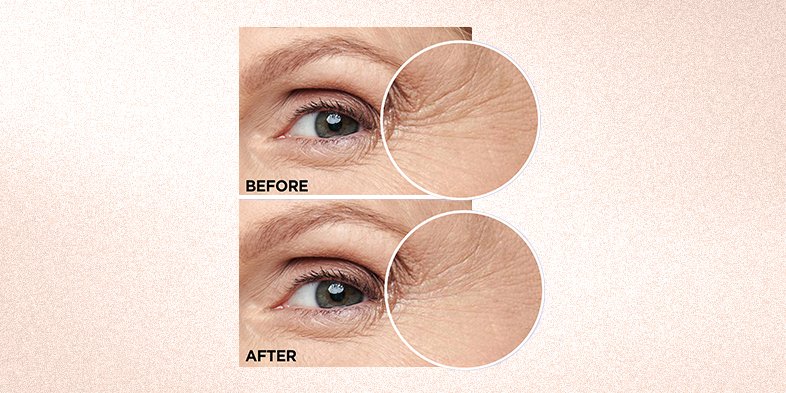 InArticlehowtoevenskintonehyaluronic Acid Caffeine Eye Serum BA